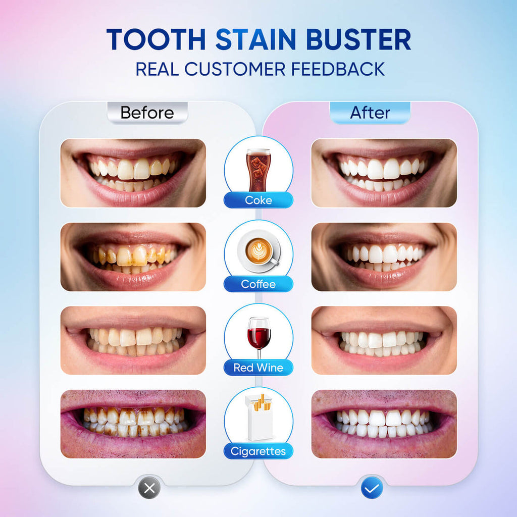 Whitening Toothpaste